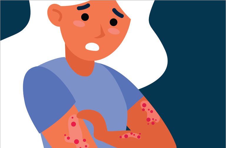 ������� � �������: ������� �����������