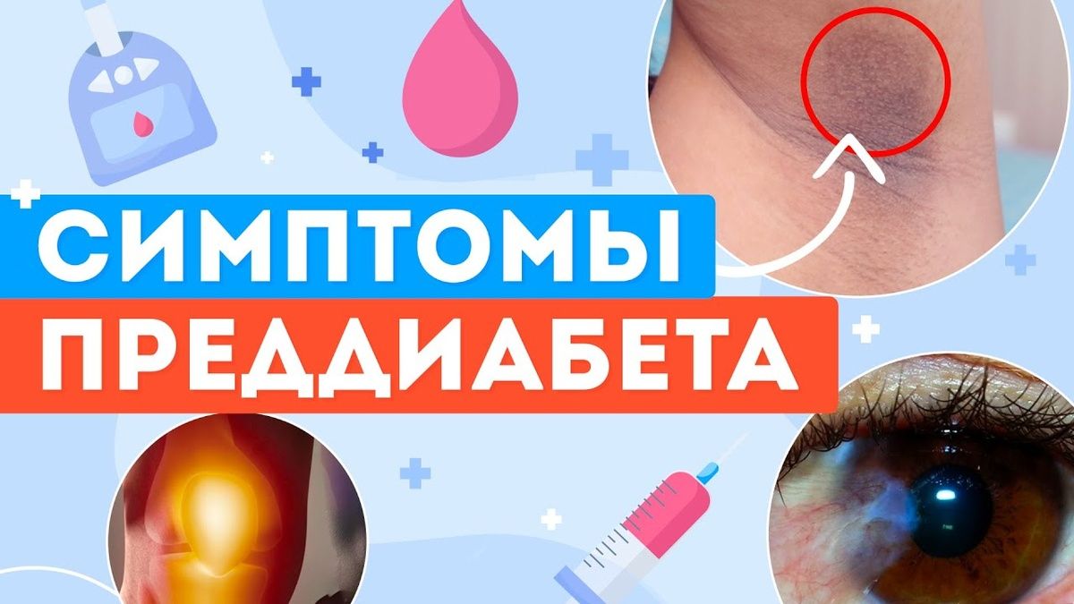 Сигналы организма, которые могут предвещать диабет